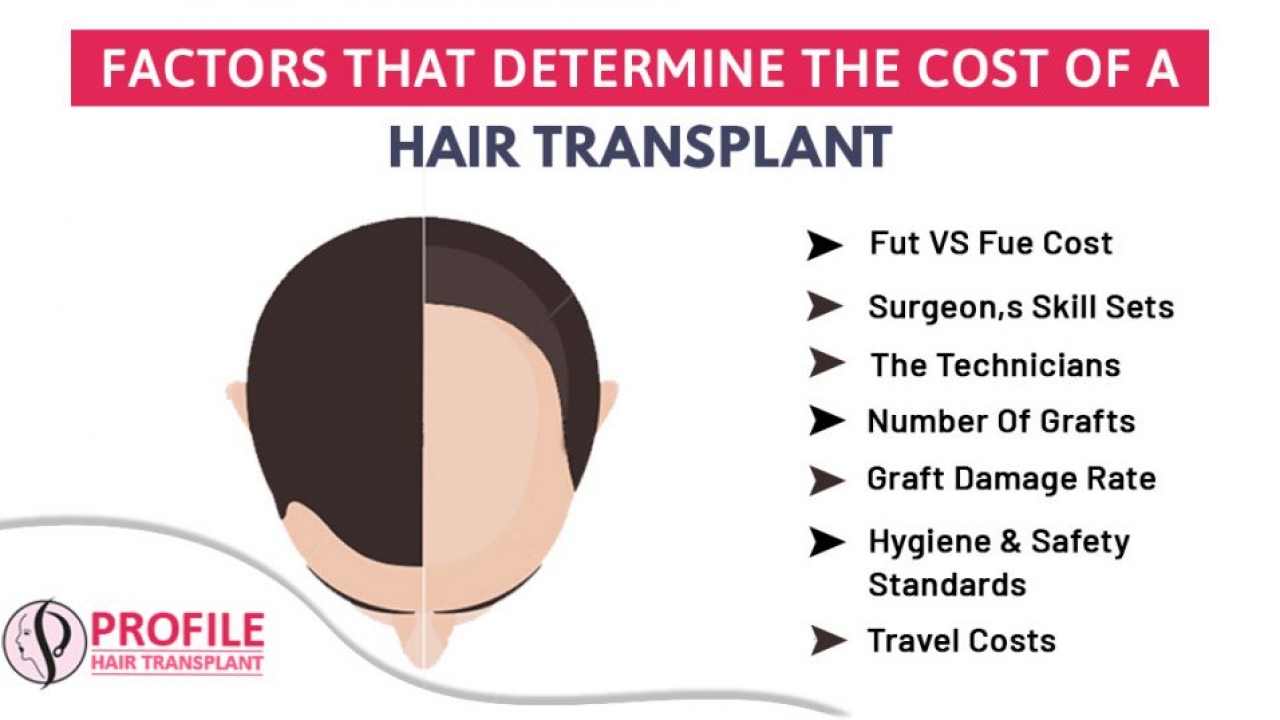 Hair Transplant Cost: Don’t Worry, It is not at all pocket pinching
