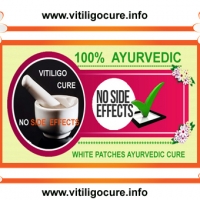vitiligo cure guide