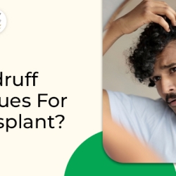 Why do men more than women suffer from hair fall problems?